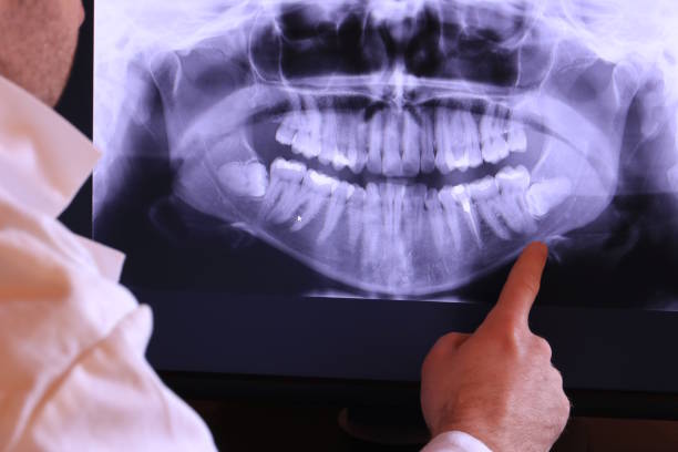 Best Emergency Tooth Extraction in Lake Park, NC