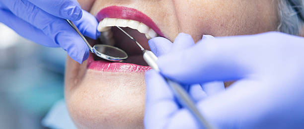 Best Emergency Wisdom Teeth Removal in Lake Park, NC